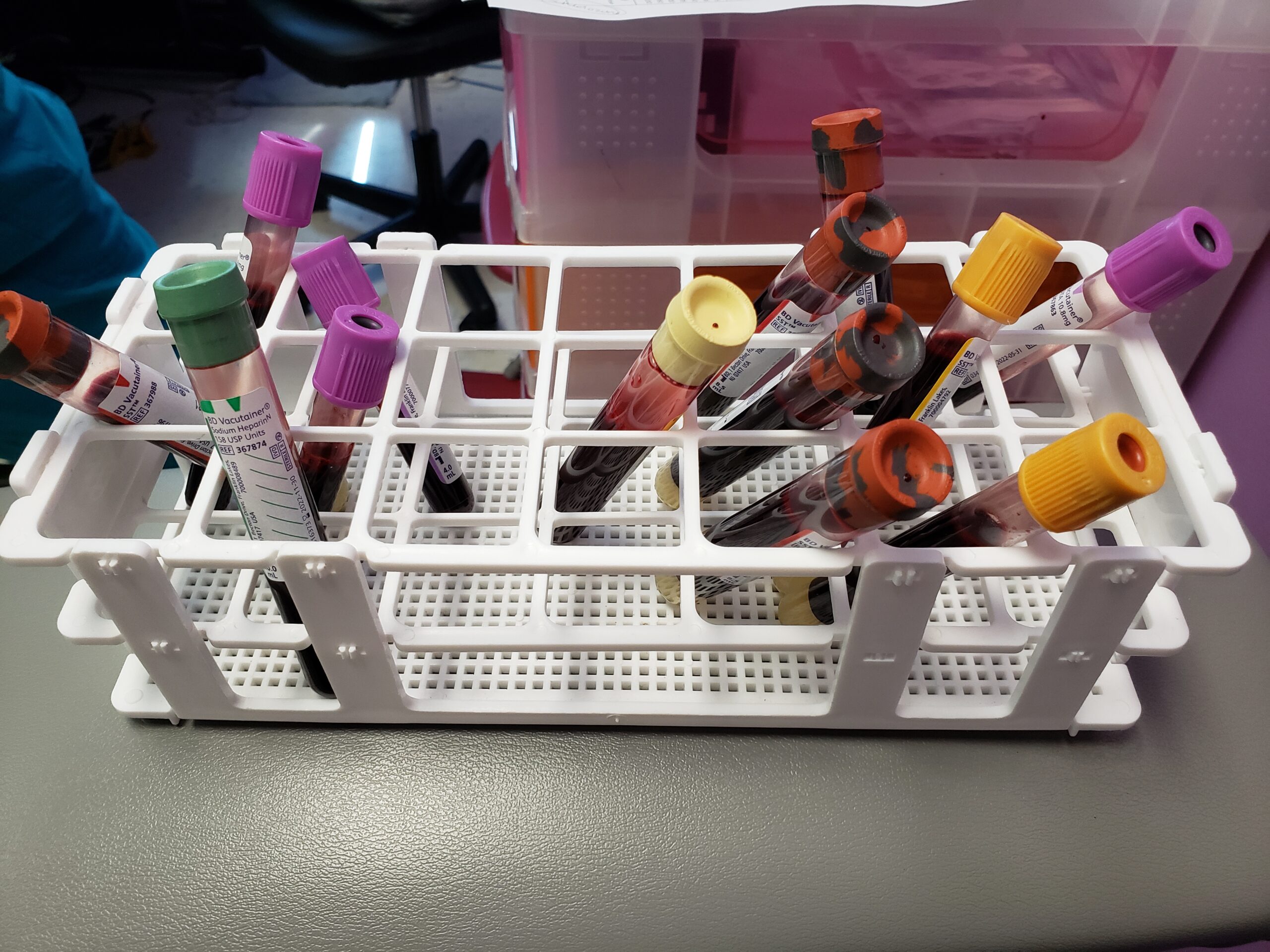 Top 5 Root Causes of Autoimmunity